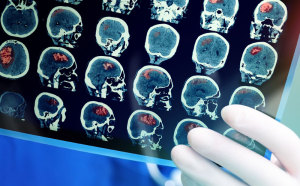 Sample of Biomedical Image Processing